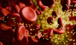 cholesterol-plaque-in-bloodstream