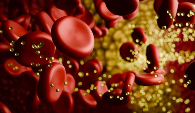 cholesterol-plaque-in-bloodstream