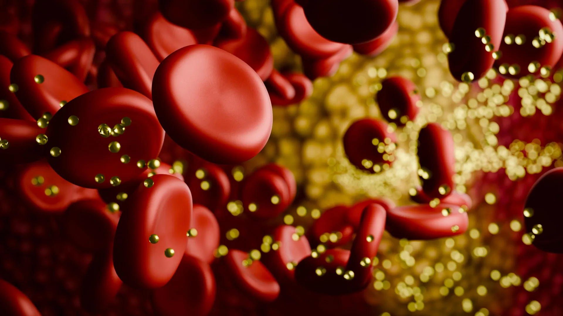 cholesterol-plaque-in-bloodstream
