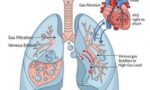 pfo-graphic