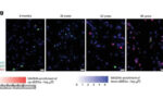 psychad-projesi-arastirmacilari-13-milyon-beyin-hucresini-inceleyerek-beynin-24-ve-60-yaslarinda-kirilma-yasadigini-kanitladi-zboi